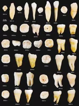 为什么有的人是28颗牙齿，有人是32颗？有人是尖牙，有人长兔牙？