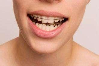 牙齿矫正好后不能任性，你的保持器可能还要戴一辈子！