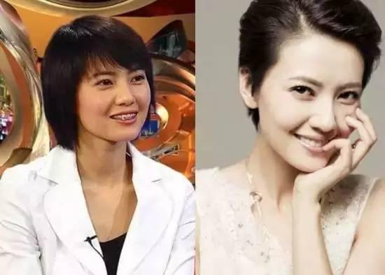 刘涛的牙不健康马薇薇的牙白过头，为什么明星人人要做牙齿整形？