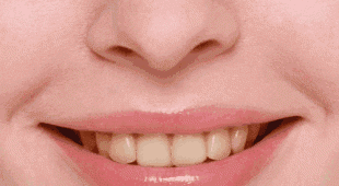 13大日本牙齿美白神器，让你彻底摆脱大黄牙！