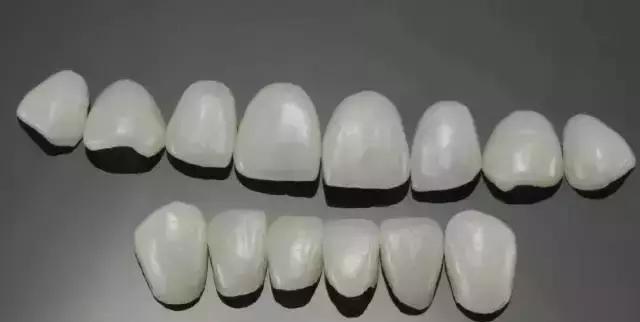 Helen齿科中心——微创，效果又持久的牙齿美容方式——全瓷贴面