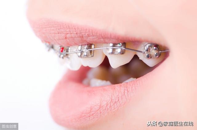 牙齿矫正为什么要磨牙？会损害牙齿吗？看看文章怎么说